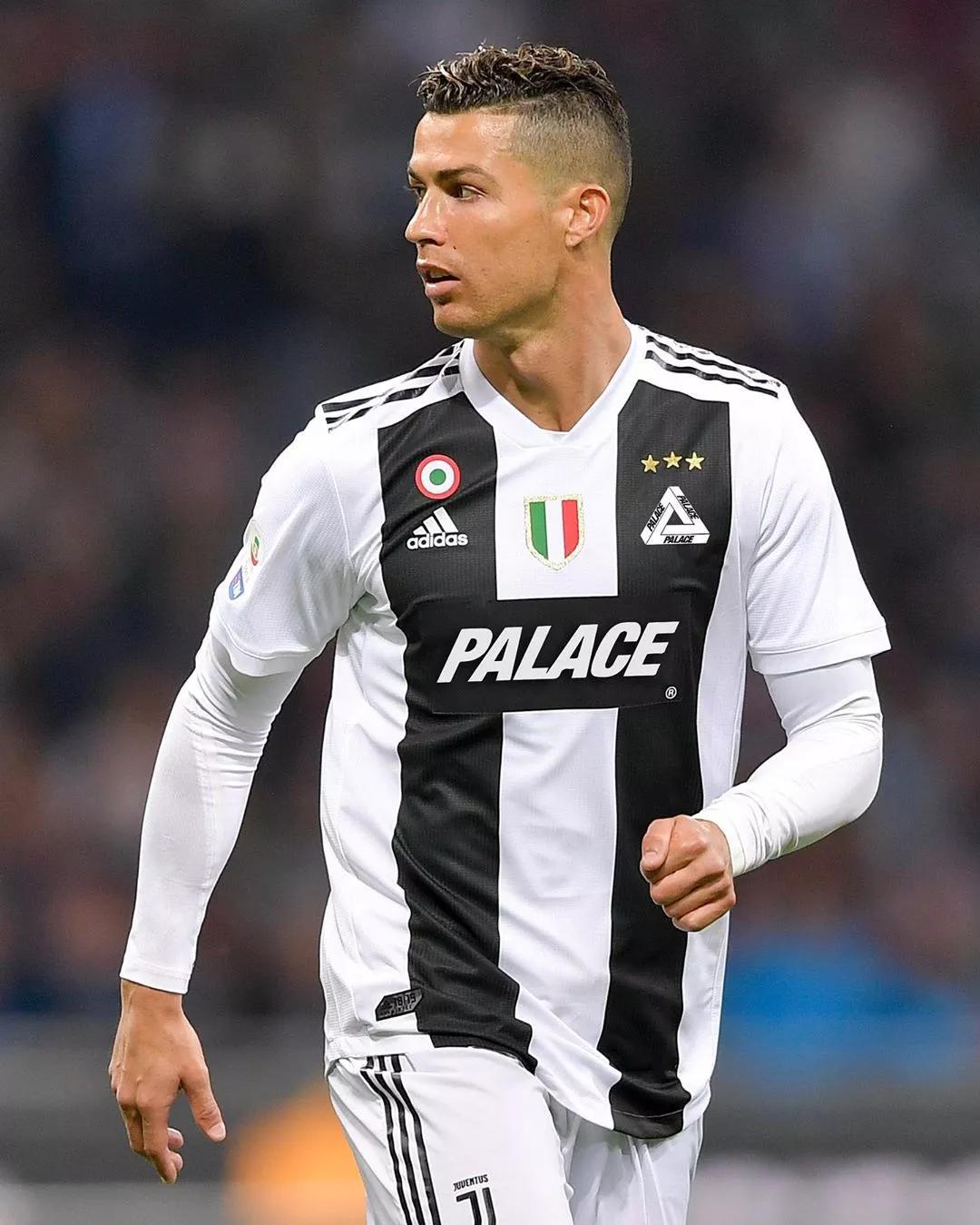 贝尔戈米：看看那不勒斯有多少人缺阵，如今他们比上赛季更强（贝尔戈米：尽管缺兵少将，如今的那不勒斯比上赛季更强）